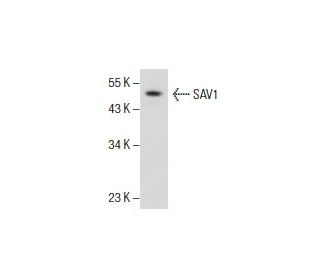 SAV1 Antibody (JJ-6) - Western Blotting - Image 154881 