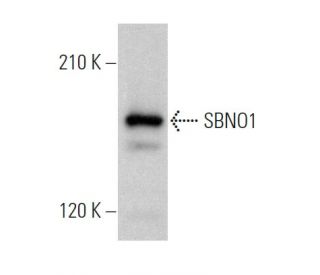 SBNO1 Antibody (A-5) - Western Blotting - Image 367444 