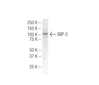 SBP-2 Antibody (2957C2a) - Western Blotting - Image 47863 