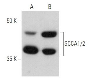 western blotting image from recommended SCCA1/2 (B-9) monoclonal antibody replacement. Image 358434