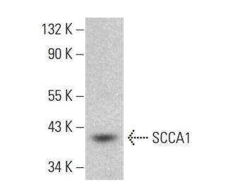 SCCA1 Antibody (8H11) - Western Blotting - Image 380362 