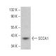SCCA1 Antibody (8H11) - Western Blotting - Image 380362 