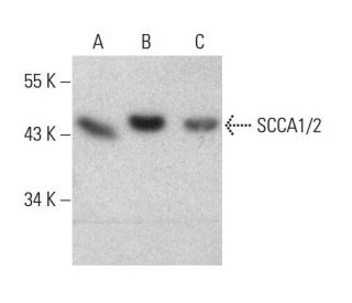 SCCA1/2 Antibody (B-9) - Western Blotting - Image 376889