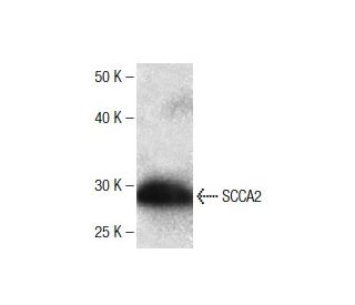 SCCA2 Antibody (39) - Western Blotting - Image 136773 
