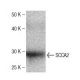 SCCA2 Antibody (64) - Western Blotting - Image 136772