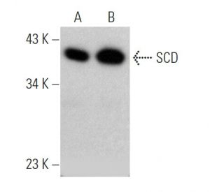 SCD Antibody (CD.E10) - Western Blotting - Image 368572