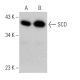 SCD Antibody (CD.E10) - Western Blotting - Image 368572