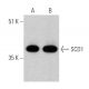 western blotting image from recommended SCD1 (E-8) monoclonal antibody replacement. Image 370441