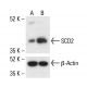 SCD2 Antibody (H-12) - Western Blotting - Image 411766