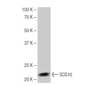 SCG10 Antibody (2-RE19) - Western Blotting - Image 65121 