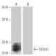 SCG10 Antibody (2-RE19) - Western Blotting - Image 65120