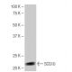 SCG10 Antibody (2-RE19) - Western Blotting - Image 65121 