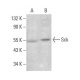 Sck Antibody (E-3) - Western Blotting - Image 383898