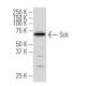 Sck Antibody (R12.1) - Western Blotting - Image 34227 