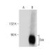 Sck Antibody (R12.1) - Western Blotting - Image 164362