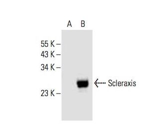Scleraxis Antibody (A-7) - Western Blotting - Image 393531 