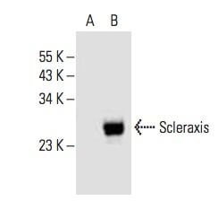 Scleraxis Antibody (A-7) | SCBT - Santa Cruz Biotechnology