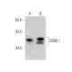 SCML1 Antibody (8-RY28) - Western Blotting - Image 385138 