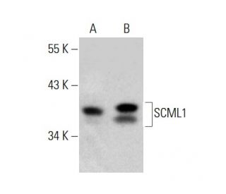 SCML1 Antibody (8-RY28) - Western Blotting - Image 385138