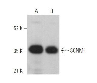 SCNM1 Antibody (F-9) - Western Blotting - Image 371297 