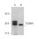SCNM1 Antibody (F-9) - Western Blotting - Image 371291 