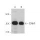 SCNM1 Antibody (F-9) - Western Blotting - Image 371297 