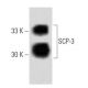 SCP-3 Antibody (25) - Western Blotting - Image 60437