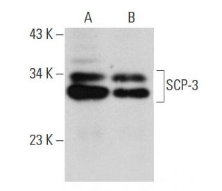 SCP 3 Antibody G 3 SCBT Santa Cruz Biotechnology