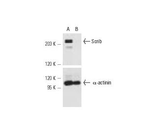 Scrib siRNA (h): sc-36466. Western blot analysis of Scrib expression in non-transfected control (A) and Scrib siRNA transf 