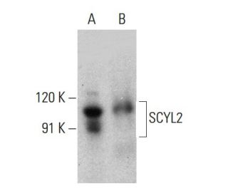 SCYL2 Antibody (B-3) - Western Blotting - Image 376858 