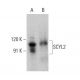 SCYL2 Antibody (B-3) - Western Blotting - Image 376858 