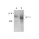 SCYL2 Antibody (B-3) - Western Blotting - Image 386112