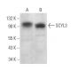 SCYL3 Antibody (E-7) - Western Blotting - Image 369072 