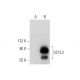 SCYL3 Antibody (G-8) - Western Blotting - Image 303807