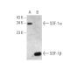 SDF-1/CXCL12 Antibody (F-4) - Western Blotting - Image 394936 