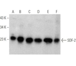 SDF-2 Antibody (J-22) - Western Blotting - Image 368237Each CRISPR/Cas9 Knockout (KO) Plasmid product consists of a pool of 3 plasmids designed to ensure identification and cleavage of a specific gene for maximum knockout efficiency. Each plasmid encodes a unique 20 nt sequence derived from the GeCKO (v2) library. 
