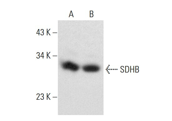 メーカー 一覧 - SCBT | (G-10) Antibody SDHB Santa Biotechnology Cruz 社交ダンス