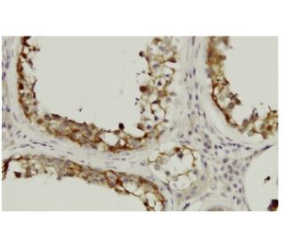 SDSL Antibody (73-K5) - Immunohistochemistry - Image 36083 