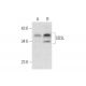 SDSL Antibody (B-8) - Western Blotting - Image 319610 