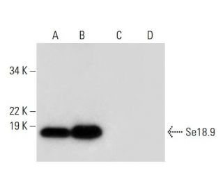 Se18.9 Antibody (B-8) - Western Blotting - Image 297967 