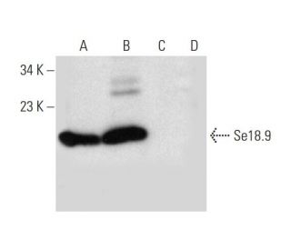 Se18.9 Antibody (H-6) - Western Blotting - Image 297877 