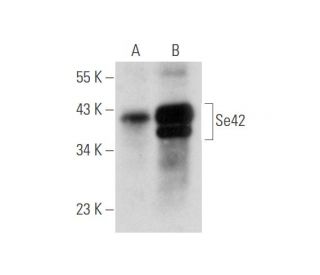 Se42 Antibody (C-10) - Western Blotting - Image 344559
