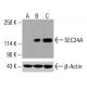 SEC24A Antibody (4D9) - Western Blotting - Image 416129 