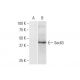 Sec63 Antibody (1A8) - Western Blotting - Image 352183 