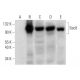 Sec8 Antibody (B-11) - Western Blotting - Image 318342 