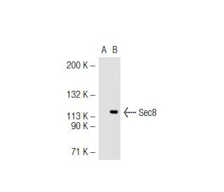 Sec8 Antibody (LB-2) - Western Blotting - Image 44447Each CRISPR/Cas9 Knockout (KO) Plasmid product consists of a pool of 3 plasmids designed to ensure identification and cleavage of a specific gene for maximum knockout efficiency. Each plasmid encodes a unique 20 nt sequence derived from the GeCKO (v2) library.