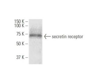 secretin receptor Antibody (3H1) - Western Blotting - Image 347575 