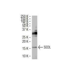 SEDL Antibody (JK-4) - Western Blotting - Image 34669