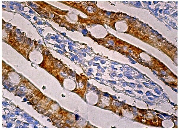 その他 H sEH Antibody (A-5) | SCBT - Santa Cruz Biotechnology
