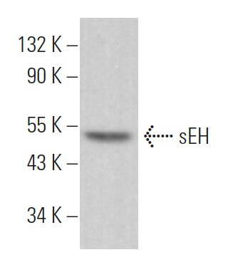 その他 H sEH Antibody (A-5) | SCBT - Santa Cruz Biotechnology